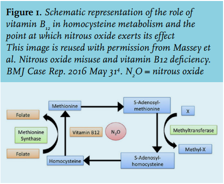 Overwinnen Midden Sluier Article: Is nitrous oxide really that joyful? (full text) - September 2017  - NJM